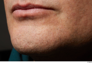  HD Face skin references Lukas Mina lips mouth skin pores skin texture 0010.jpg